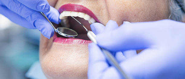 Best Cracked Tooth Emergency Dentist  in Comer, GA